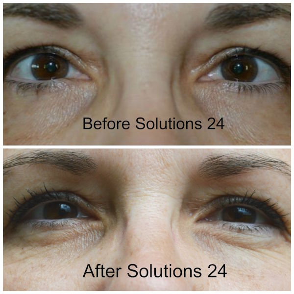 Solutions 24 Clinical Beauty